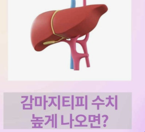 감마지티피 높으면