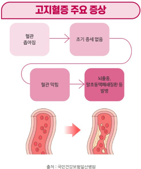 고지혈증 주요 증상에 대한 설명