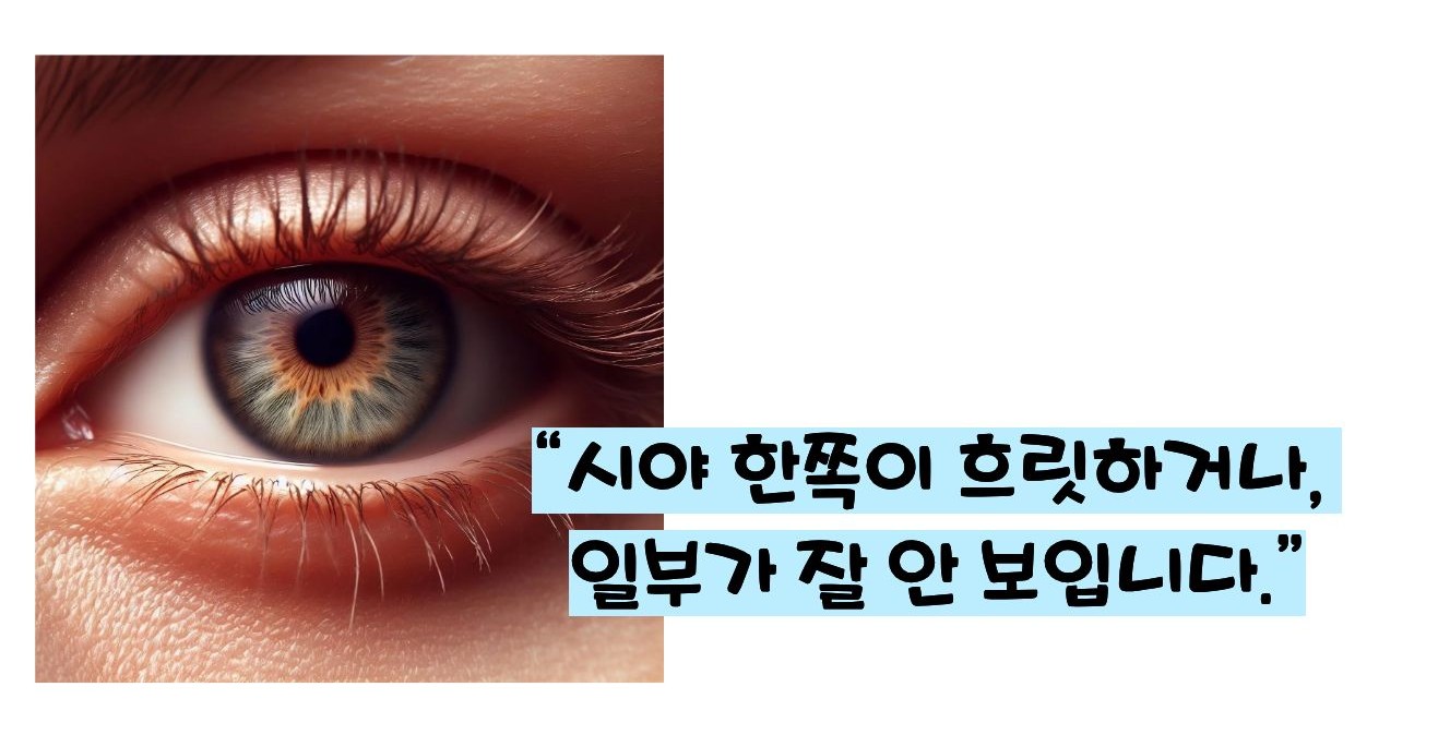 녹내장 초기증상