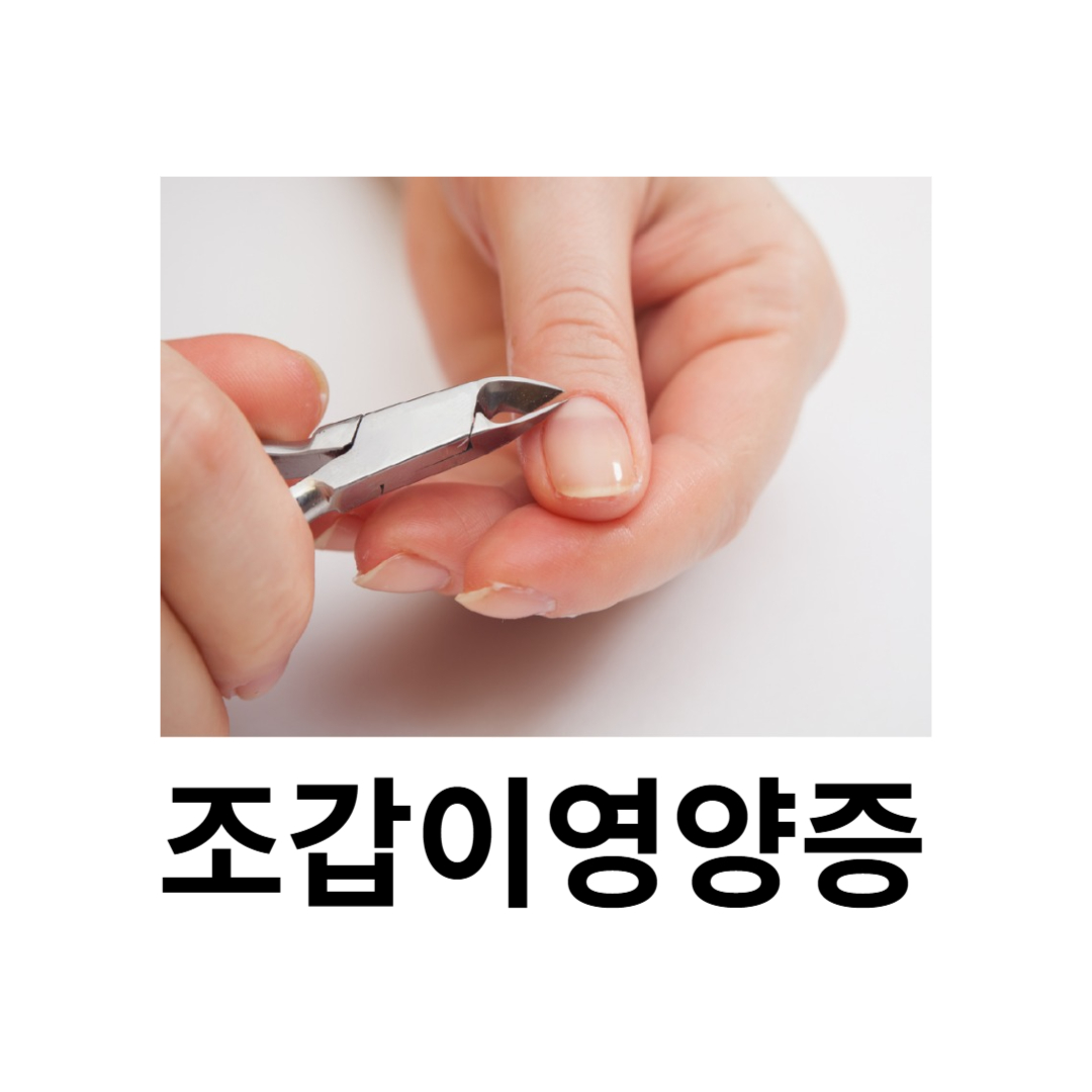 조갑이영양증과 관련된 사진입니다.