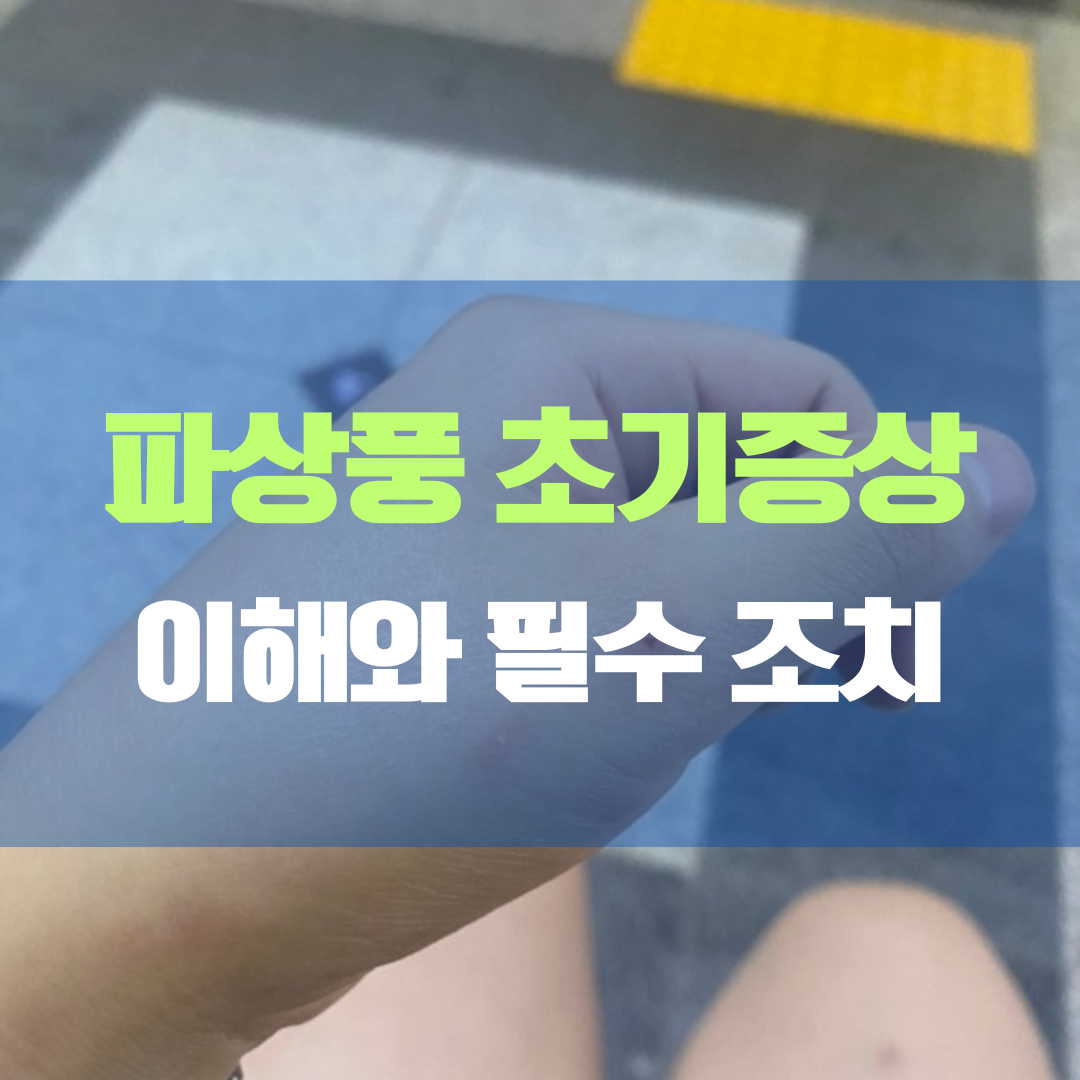 파상풍 초기증상 대처법
