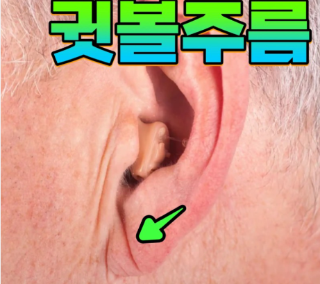 귓불 주름 건강에 신호
