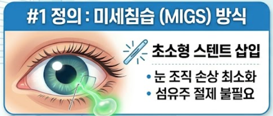 녹내장 수술