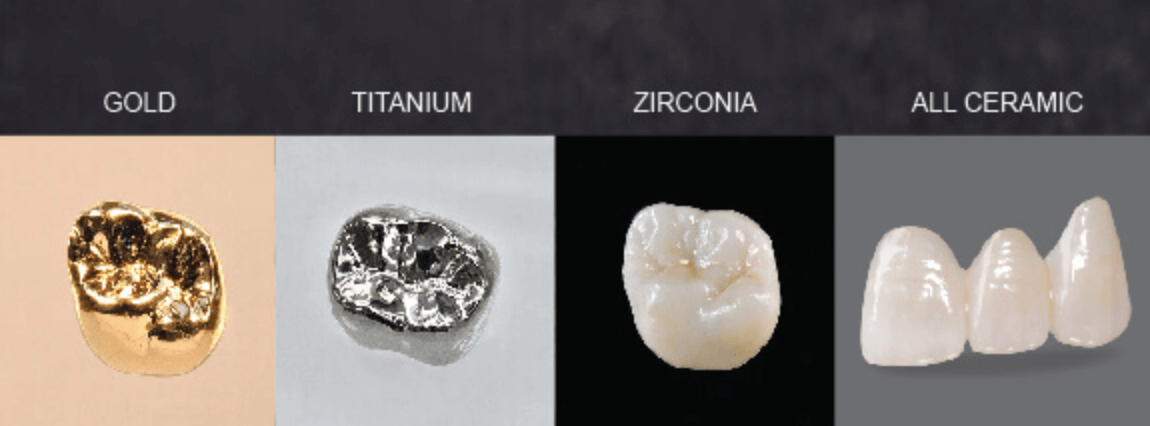 치아 크라운 종류