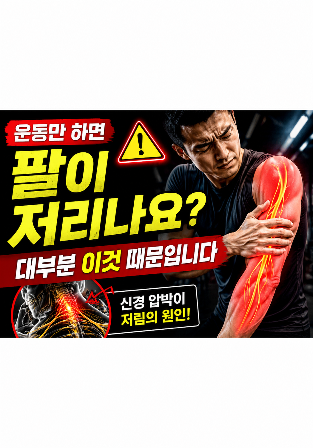 운동만 하면 팔이 저리나요