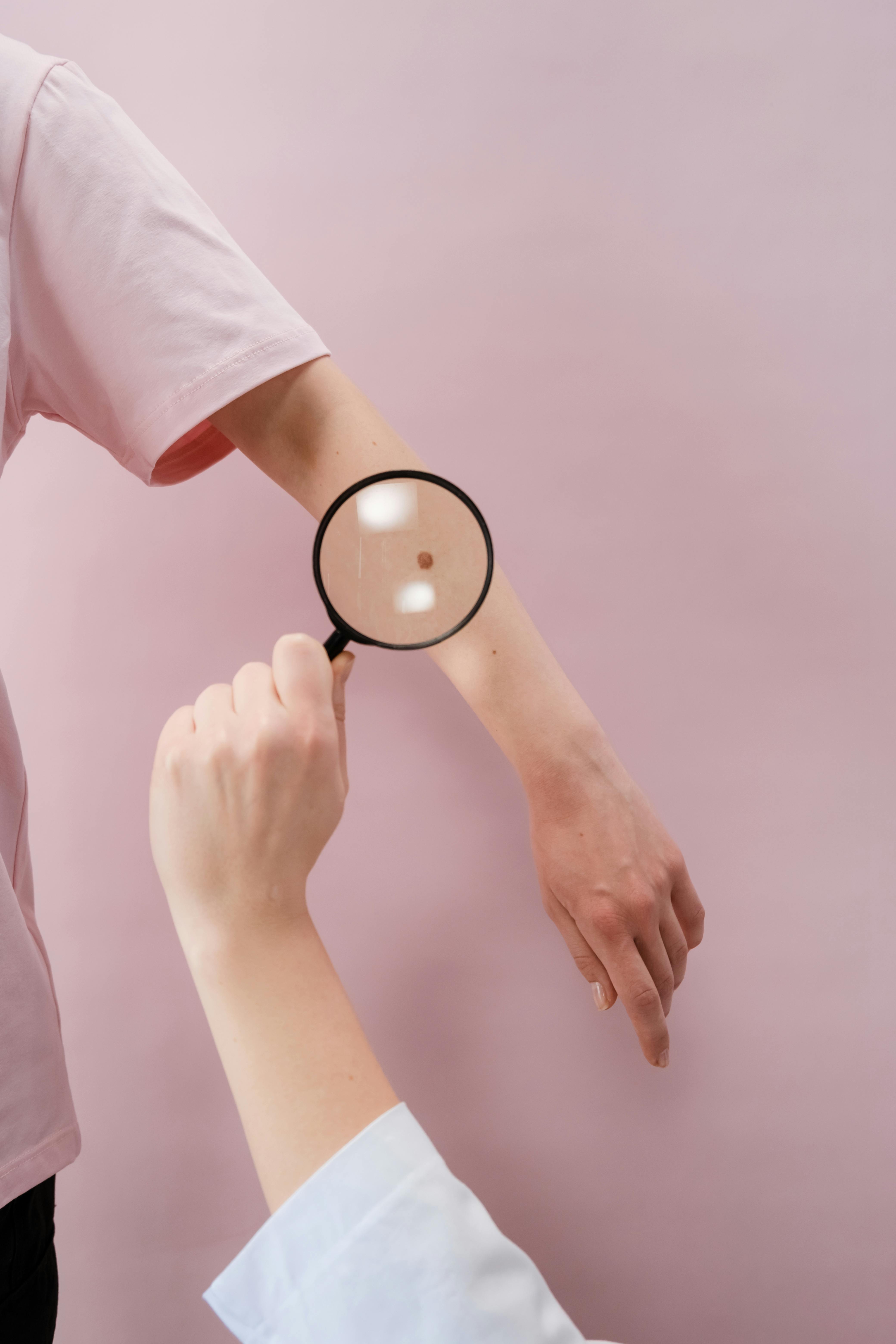 악성 흑색종, 작은 점이 보내는 위험한 신호!
(증상, 원인, 치료법)