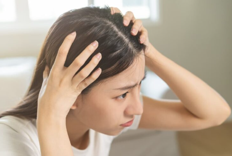 두피의 건조함.