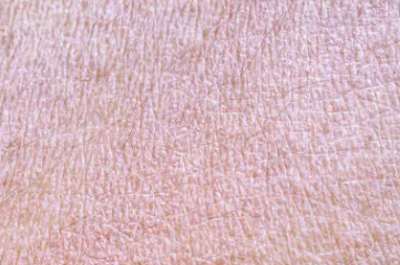 몸이 가려운 이유 30