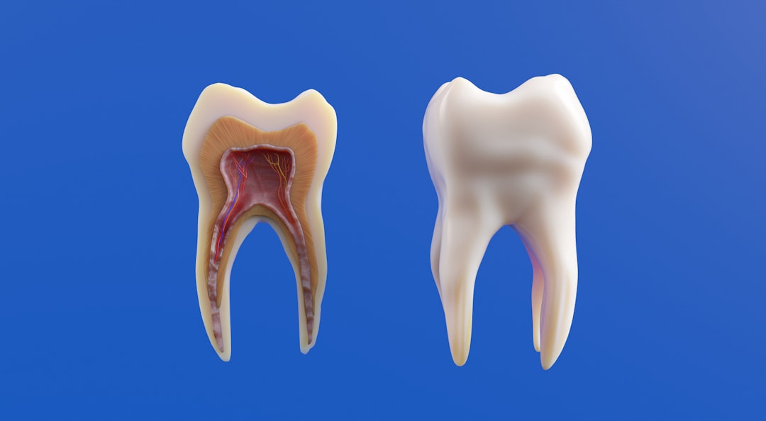 Dental insurance.