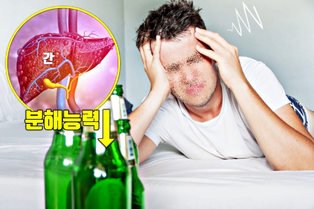 숙취, 간이 안좋을때 나타나는 증상, 간암 간경화 지방간 증상, 건강, 팁줌 매일꿀정보