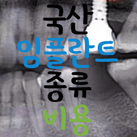 국산 임플란트를 식립한 모습