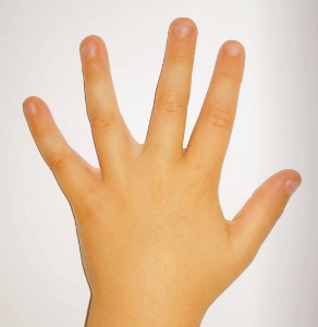 손톱에 세로줄이 생기는 이유와 검은 세로줄 원인