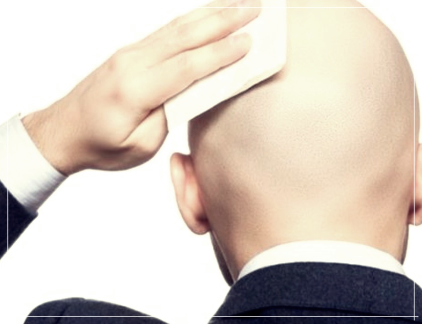 두피땀 원인으로 탈모가 생긴다면?