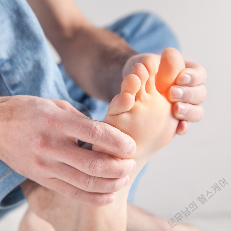 발가락 저림 증상 지간신경종