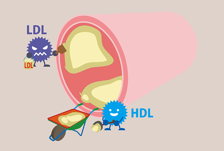 LDL콜레스테롤과-HDL 콜레스테롤