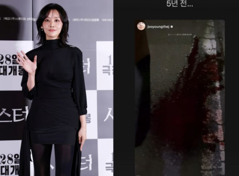 차주영 활동중단 코피 비출혈 이유와 치료방법