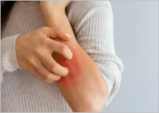 바세린이 필요한 사람들 이미지