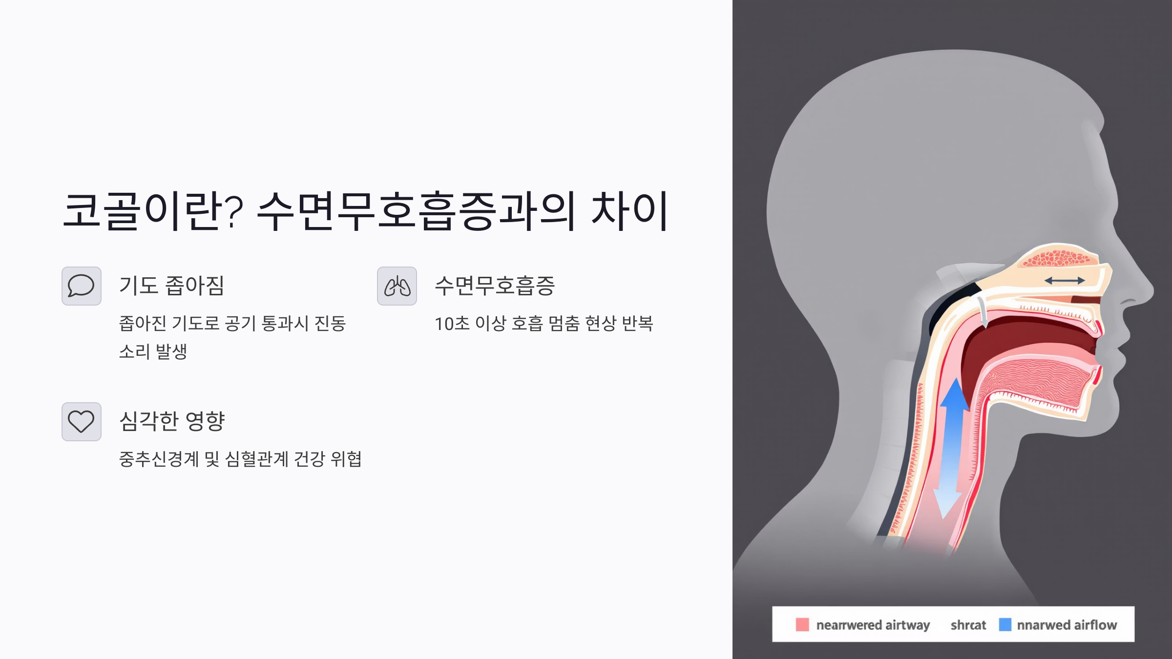왜 우리는 코를 골게 될까? 코골이 발생 원인 5가지