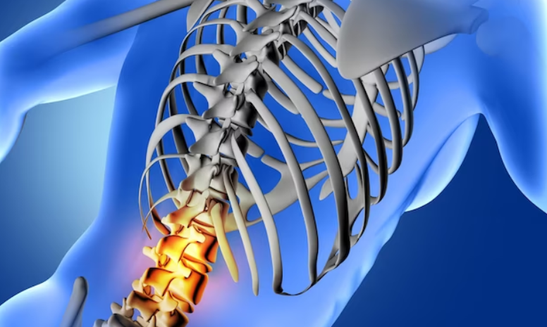 척추측만증 치료