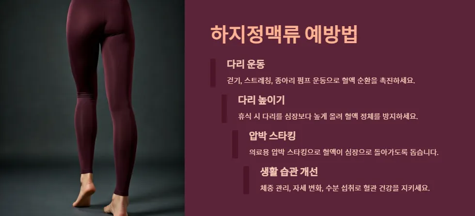 하지정맥류-예방법