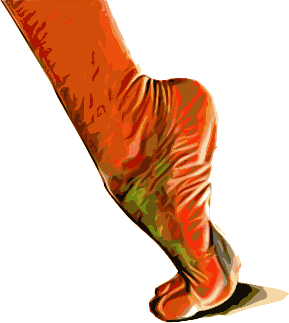 발목 관절경 수술