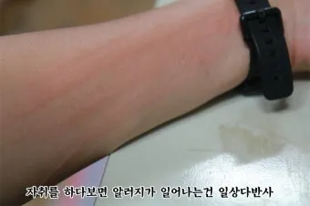 침구 진드기 햇볕 건조와 고온 살균 보관법_9
