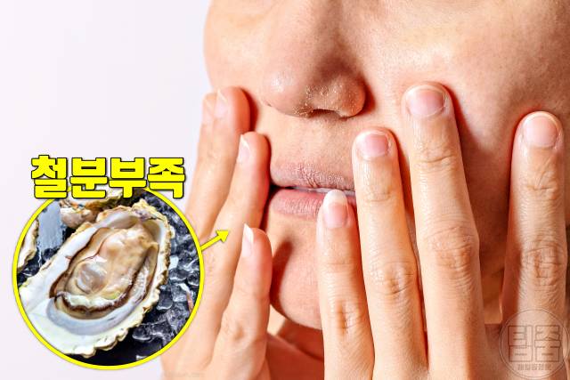 밥 잘먹는 사람 철분부족증상 얼굴각질 손톱갈라짐