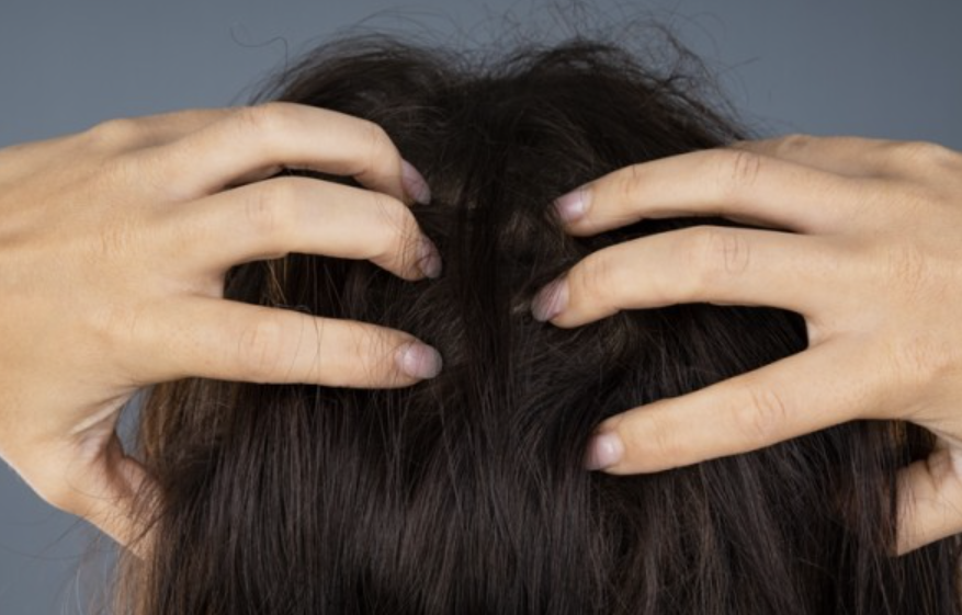 두피 가려움증 원인 1