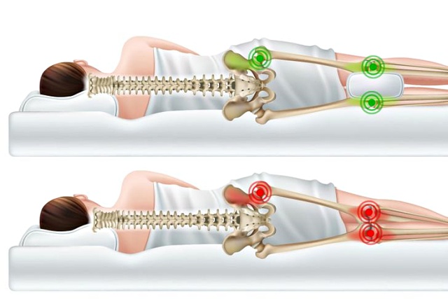 무릎 관절염 보호대 역할 베개, 건강 팁줌 매일꿀정보