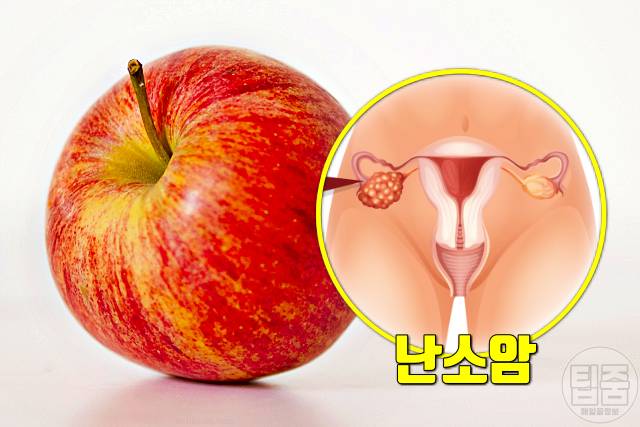 사과 매일 먹으면 항암 사과 효능 부작용