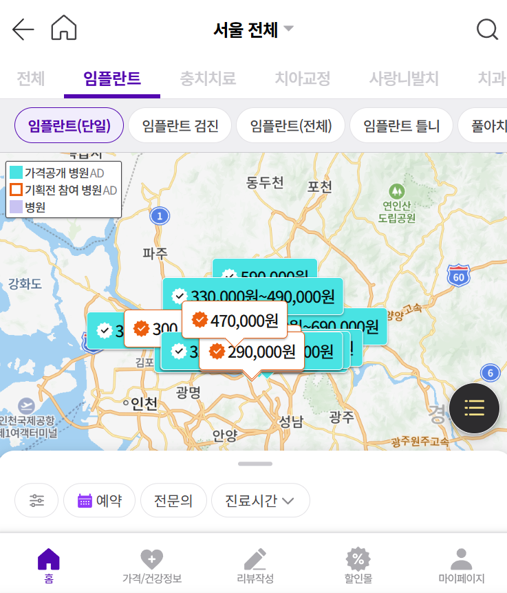 서울 임플란트 가격