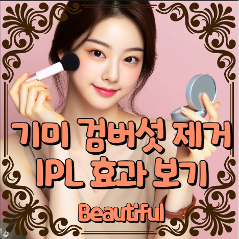 기미 검버섯 제거 IPL효과 알아보기