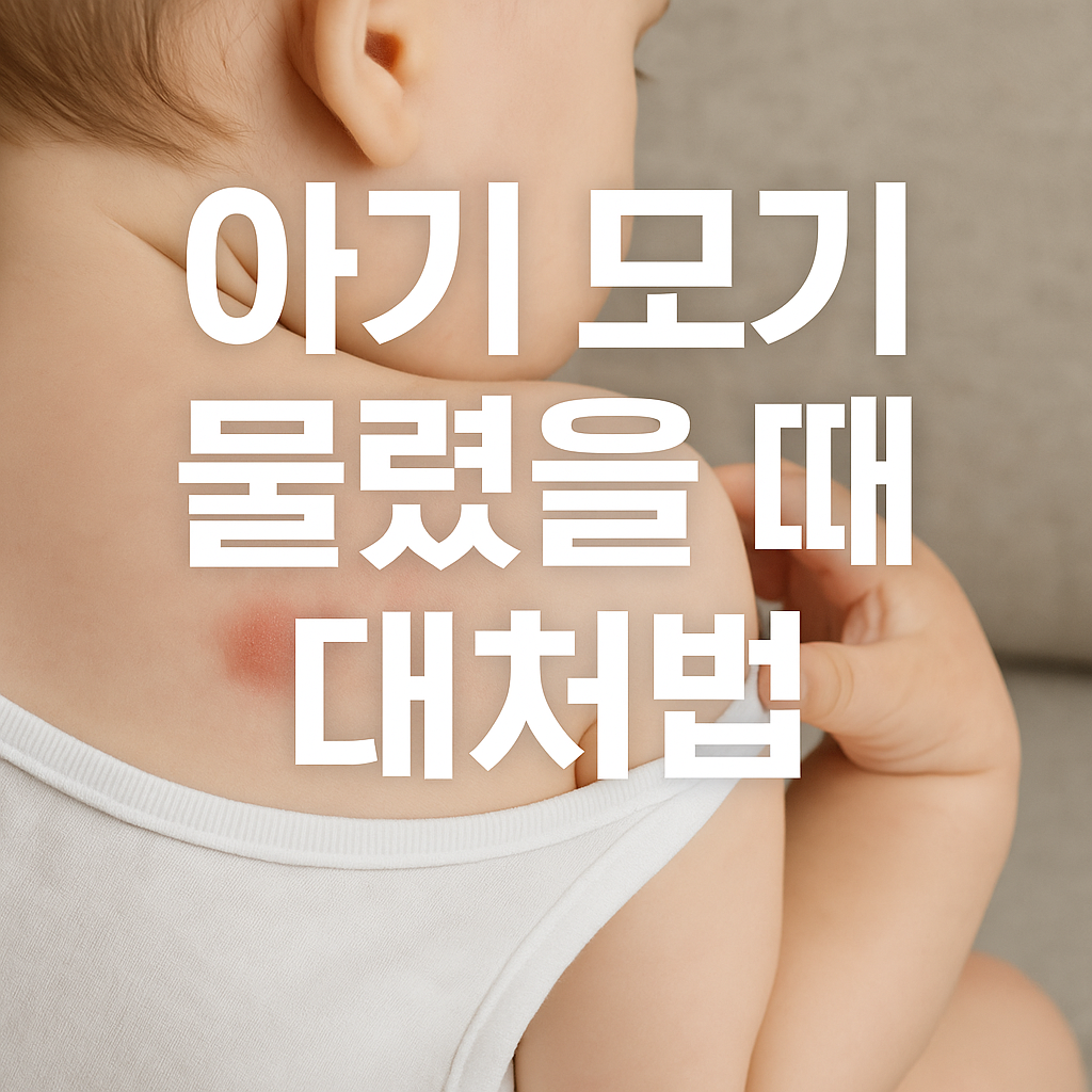 아기 모기 물렸을 때 대처법