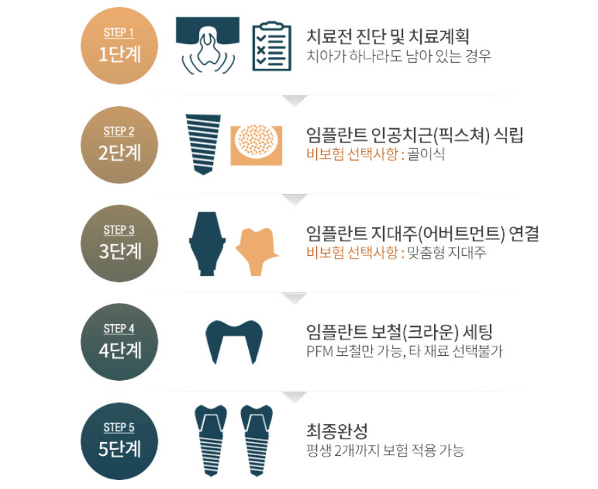 임플란트 시술절차