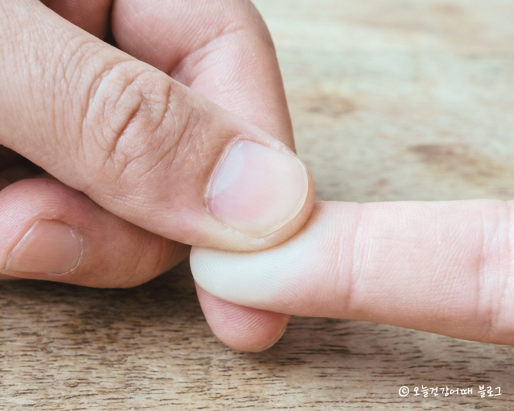 손가락자극운동, 전두엽활성화, 두뇌훈련, 치매예방습관, 뇌건강루틴, 손운동효과
