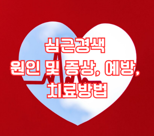 심근경색 원인 및 증상, 예방, 치료방법