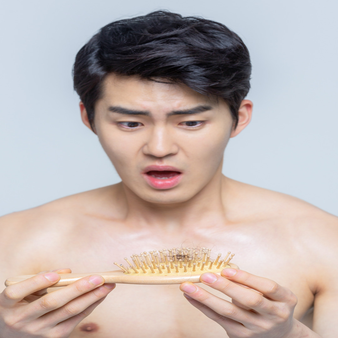 여성 탈모에 좋은 약 (저용량 미녹시딜, 영양제 병행)