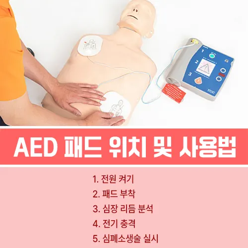 자동심장충격기 패드