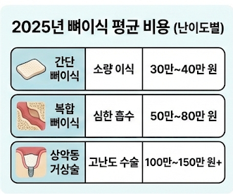 뼈이식 비용 평균표