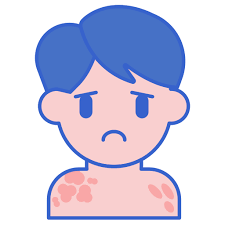 피부발진의 종류