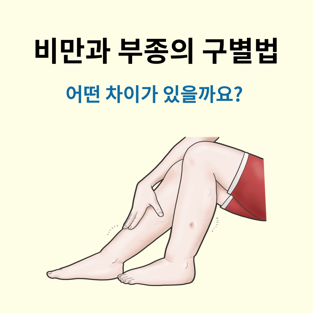 비만과 부종의 구별법, 어떤 차이가 있을까요?