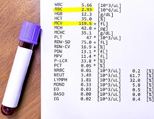 혈액검사-수치-보는-법