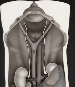 신장이 안좋으면 나타나는 증상