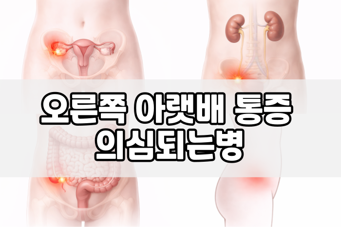 오른쪽 아랫배 통증 의심되는병