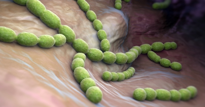 열이 나는 붓기의 봉와직염