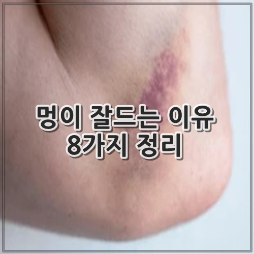 멍이 잘드는 이유 8가지