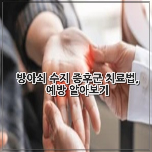방아쇠 수지 증후군 치료법, 예방 알아보기