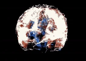 Brain