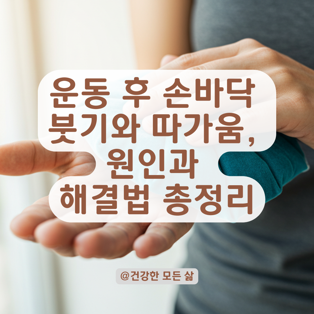 운동 후 손바닥이 계속 붓고 따가워진다면? 원인과 대처법 총정리.