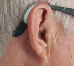 이명 치료법 진단 기준 합병증 관리